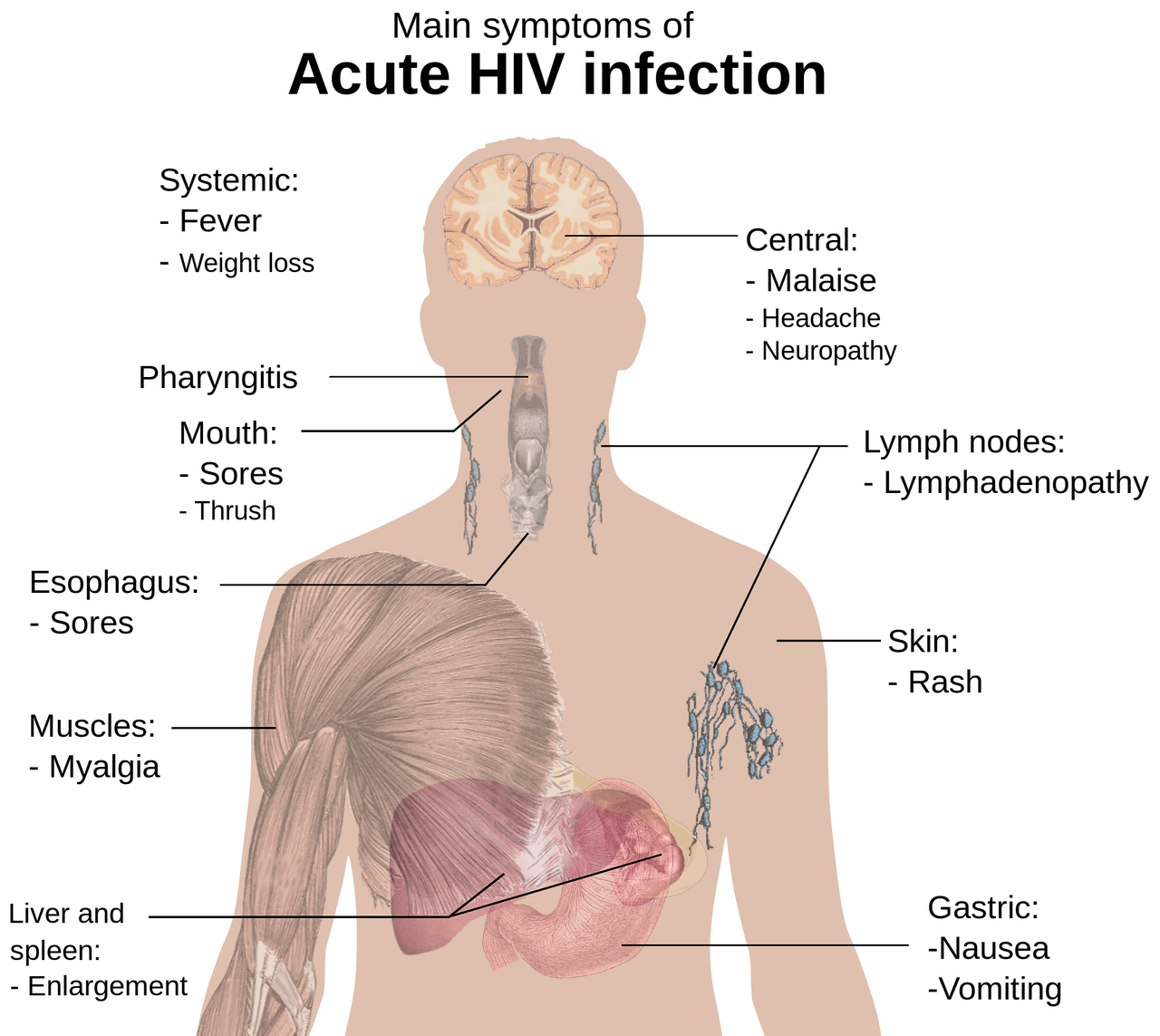 Anabolic Steroids in HIV Wasting Syndrome: Rebuilding Strength and Health