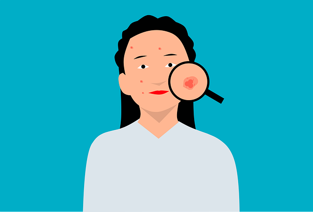 Steroids for Skin Conditions