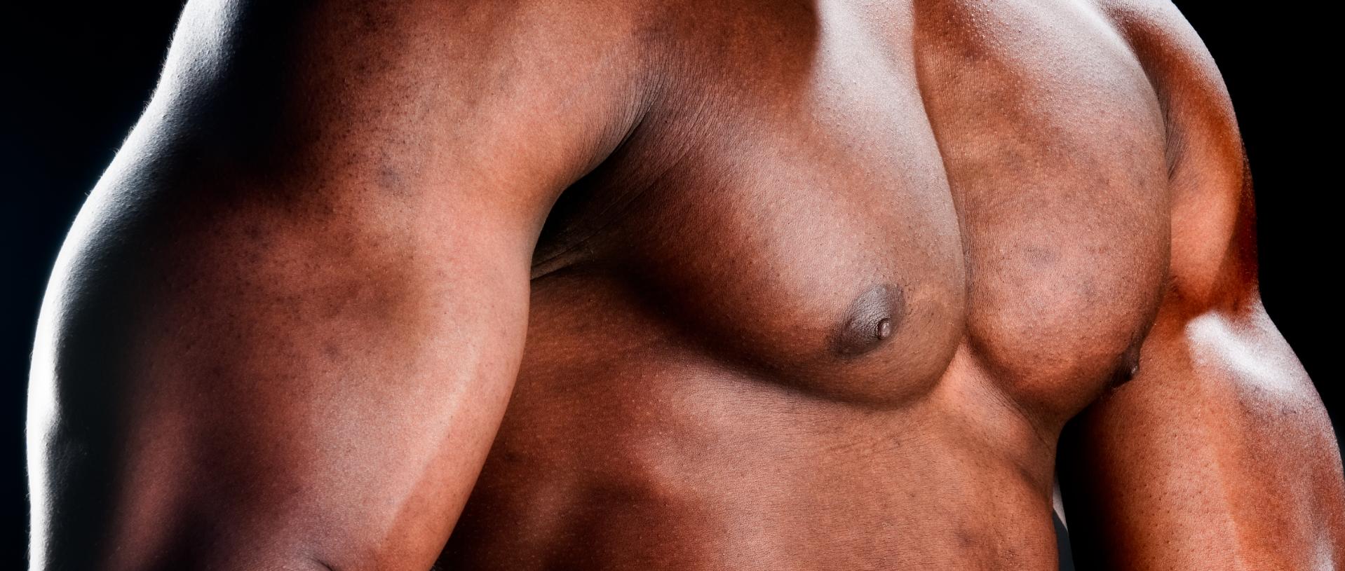 Gynecomastia in Bodybuilding: Causes, Prevention, and Solutions