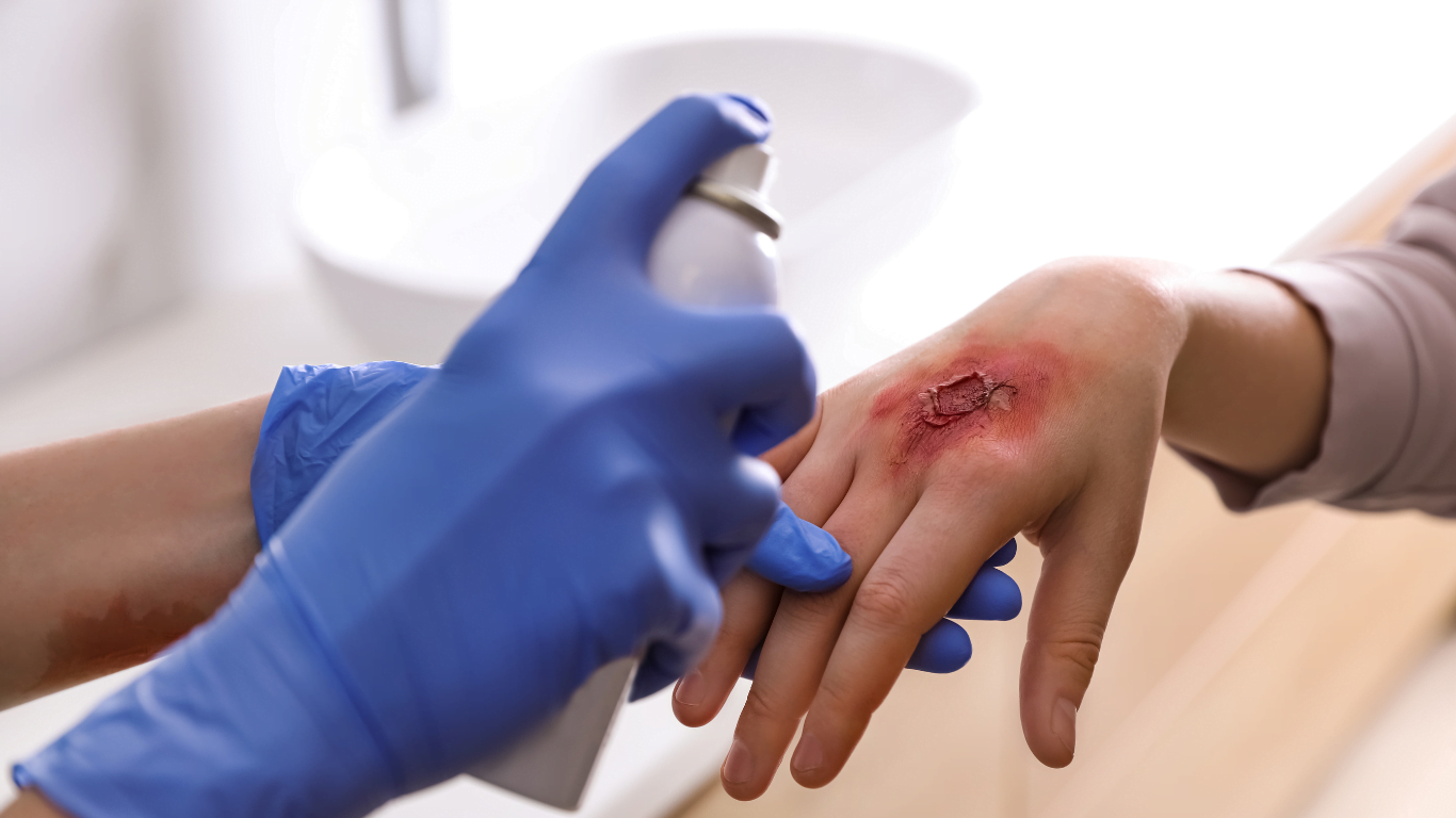 The role of anabolic steroids in the treatment of burns and severe trauma