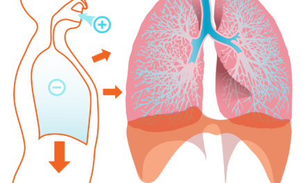 The Role of Steroids in Inhalers for Improved Respiratory Function