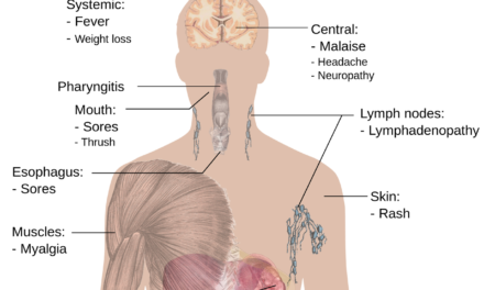 Anabolic Steroids in HIV Wasting Syndrome: Rebuilding Strength and Health