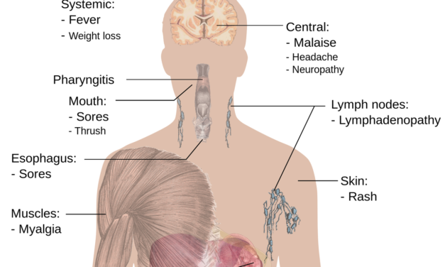 Anabolic Steroids in HIV Wasting Syndrome: Rebuilding Strength and Health