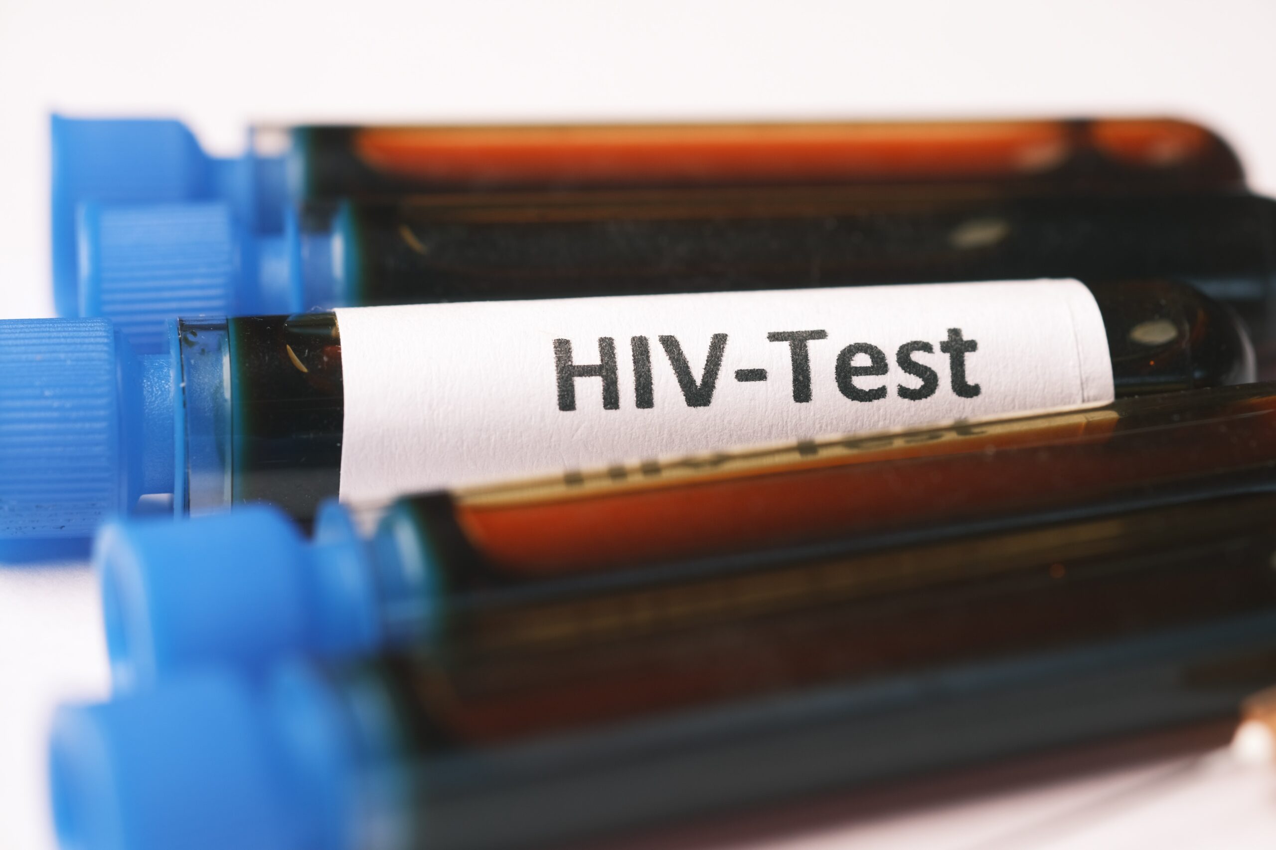 Understanding HIV Wasting Syndrome