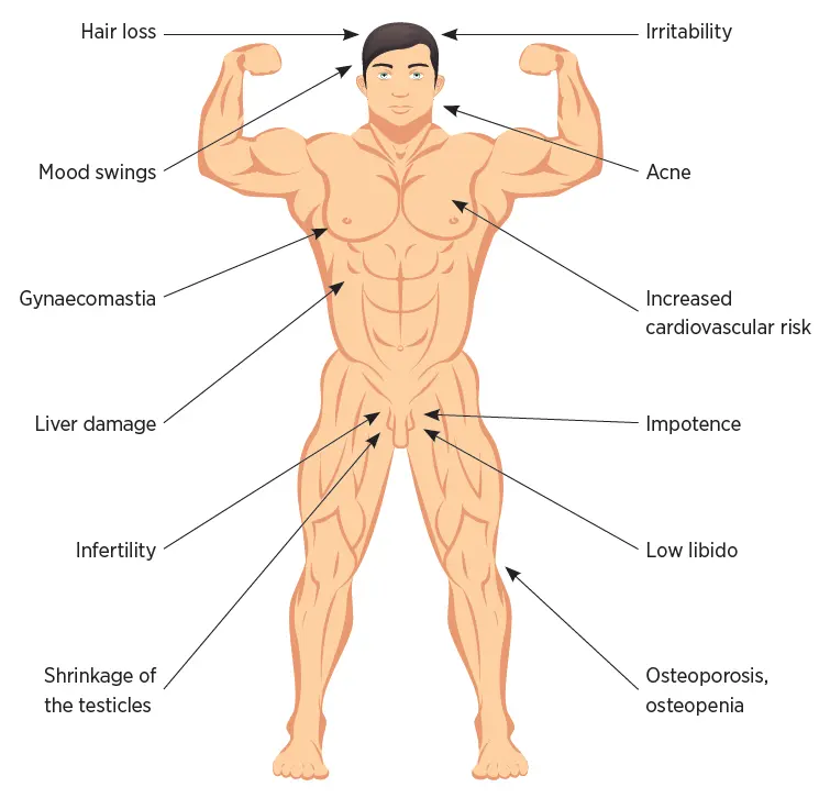 Infographic of possible Anabolic Steroids Side effects for men 