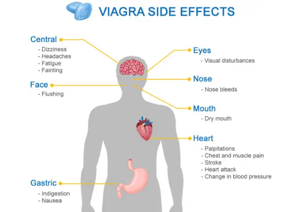 Viagra Side Effects 